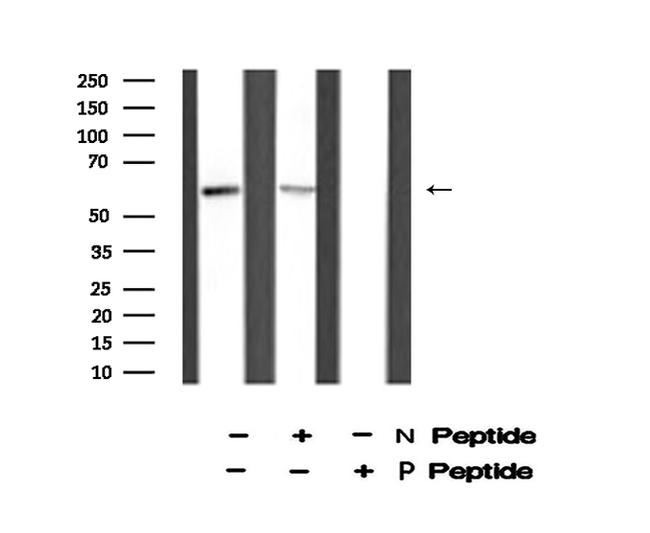 Phospho-Cyclin B1 (Ser128) Antibody in Western Blot (WB)