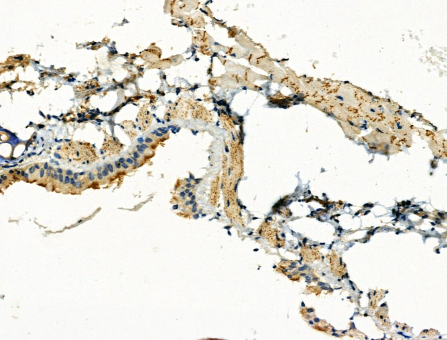 Phospho-RGS19 (Ser151) Antibody in Immunohistochemistry (Paraffin) (IHC (P))