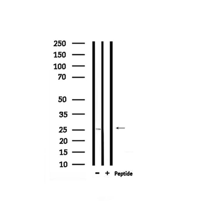 Phospho-RGS19 (Ser151) Antibody in Western Blot (WB)