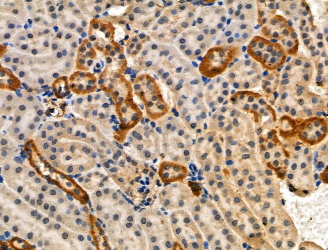 Phospho-HTRA2 (Ser212) Antibody in Immunohistochemistry (Paraffin) (IHC (P))