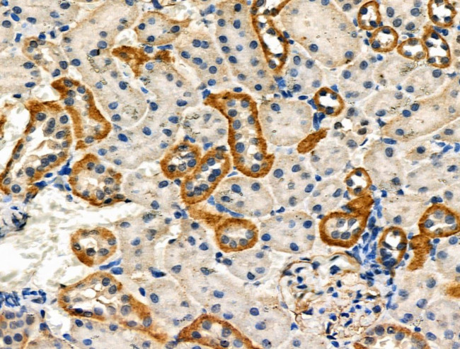 Phospho-HTRA2 (Ser212) Antibody in Immunohistochemistry (Paraffin) (IHC (P))