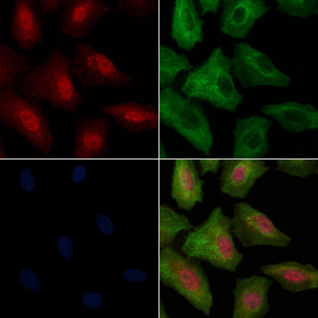 Phospho-MBP (Thr232) Antibody in Immunocytochemistry (ICC/IF)