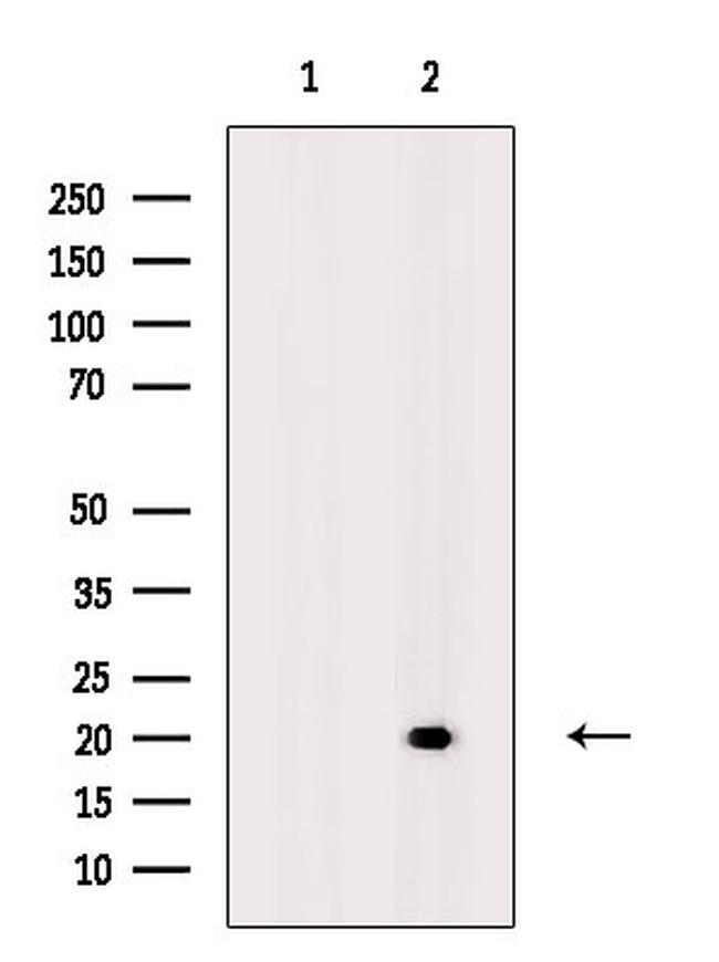 Phospho-MBP (Thr232) Antibody in Western Blot (WB)