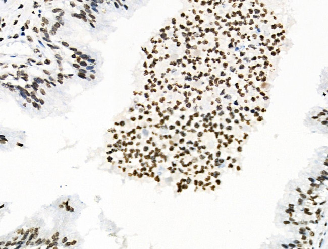 Phospho-MUC1 (Ser1227) Antibody in Immunohistochemistry (Paraffin) (IHC (P))