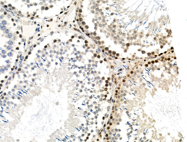 Phospho-MUC1 (Ser1227) Antibody in Immunohistochemistry (Paraffin) (IHC (P))