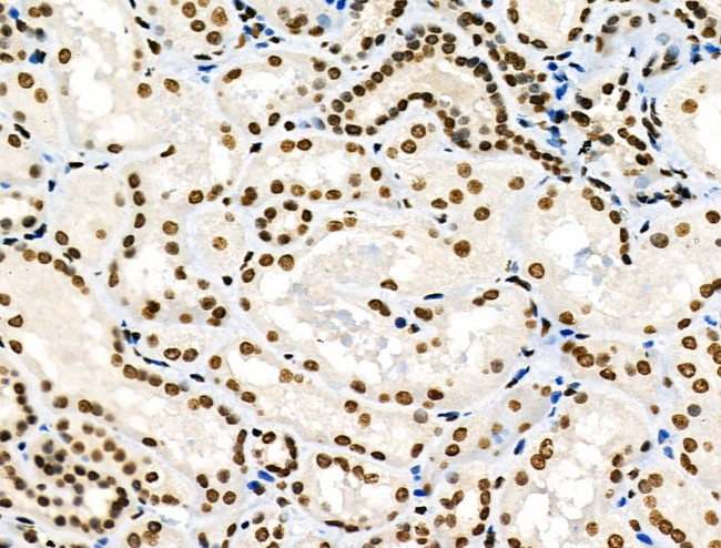 Phospho-MUC1 (Ser1227) Antibody in Immunohistochemistry (Paraffin) (IHC (P))