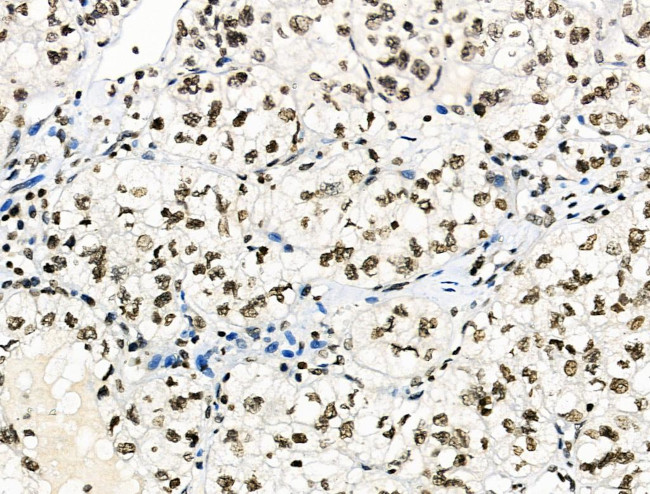 Phospho-MUC1 (Ser1227) Antibody in Immunohistochemistry (Paraffin) (IHC (P))