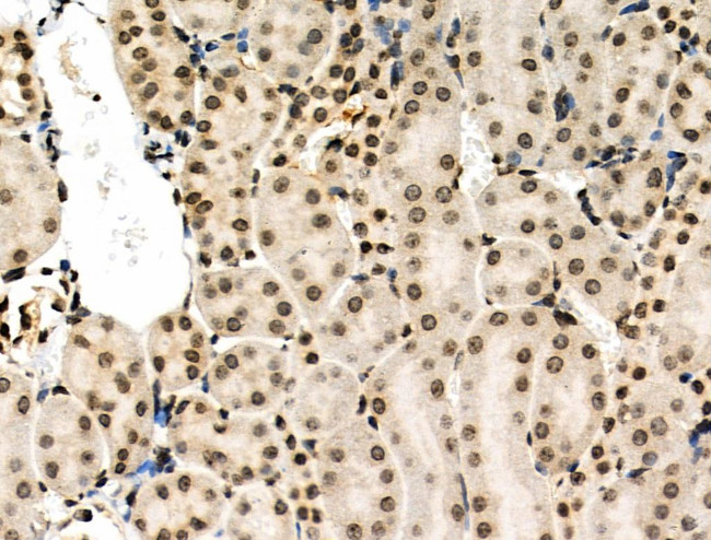 Phospho-MUC1 (Ser1227) Antibody in Immunohistochemistry (Paraffin) (IHC (P))