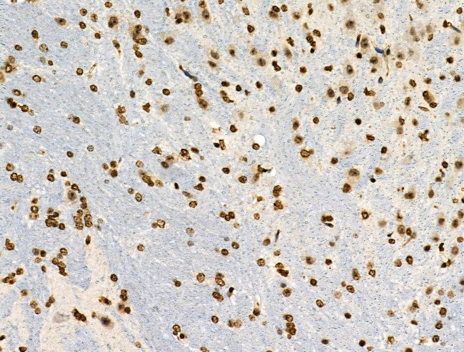 Phospho-MUC1 (Ser1227) Antibody in Immunohistochemistry (Paraffin) (IHC (P))