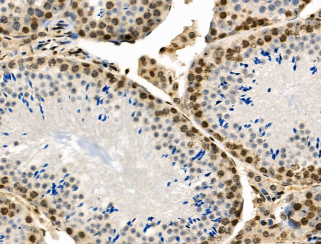 Phospho-MUC1 (Ser1227) Antibody in Immunohistochemistry (Paraffin) (IHC (P))