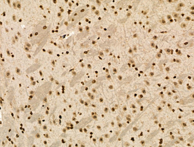 Phospho-NACA (Thr159) Antibody in Immunohistochemistry (Paraffin) (IHC (P))