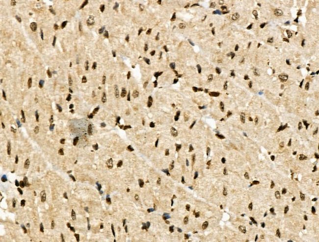 Phospho-NACA (Thr159) Antibody in Immunohistochemistry (Paraffin) (IHC (P))