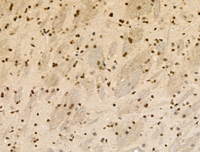 Phospho-NACA (Thr159) Antibody in Immunohistochemistry (Paraffin) (IHC (P))