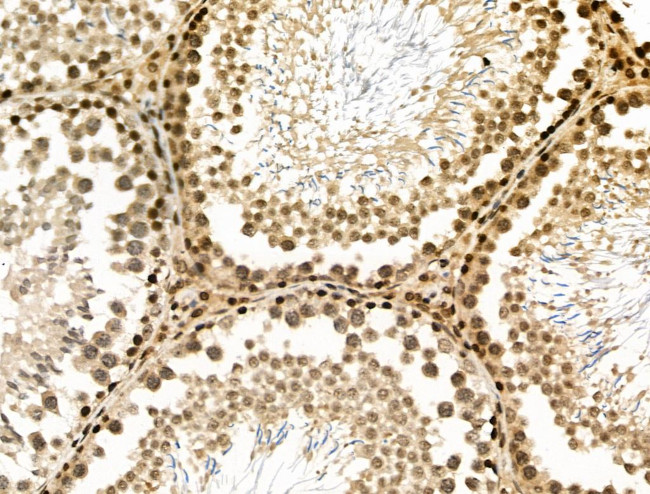 Phospho-NACA (Thr159) Antibody in Immunohistochemistry (Paraffin) (IHC (P))