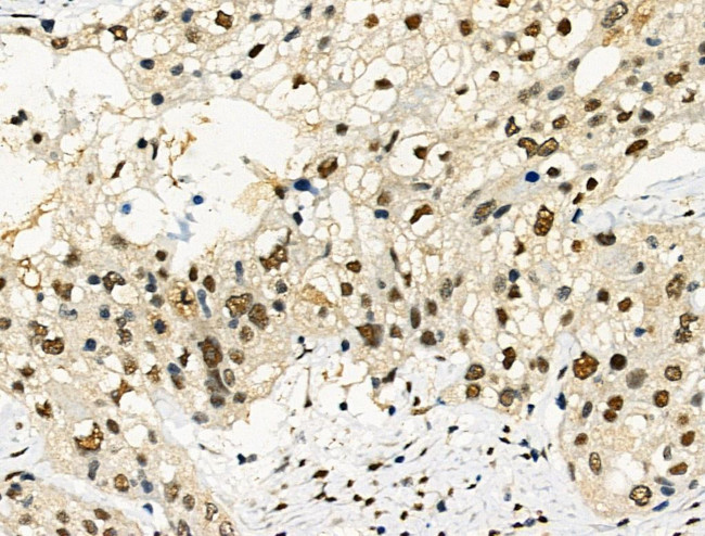 Phospho-PDX1 (Ser61) Antibody in Immunohistochemistry (Paraffin) (IHC (P))