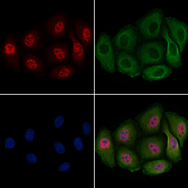 Phospho-PDX1 (Ser66) Antibody in Immunocytochemistry (ICC/IF)