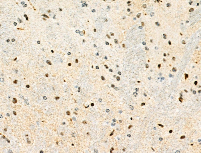 Phospho-PDX1 (Ser66) Antibody in Immunohistochemistry (Paraffin) (IHC (P))