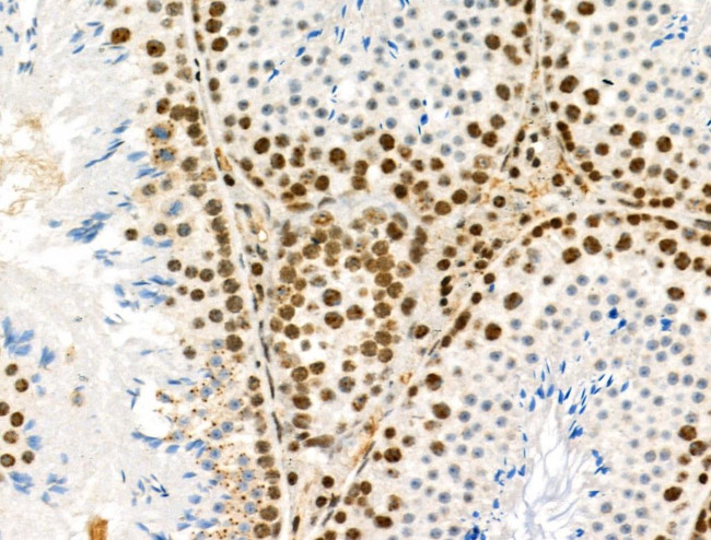 Phospho-PDX1 (Ser66) Antibody in Immunohistochemistry (Paraffin) (IHC (P))