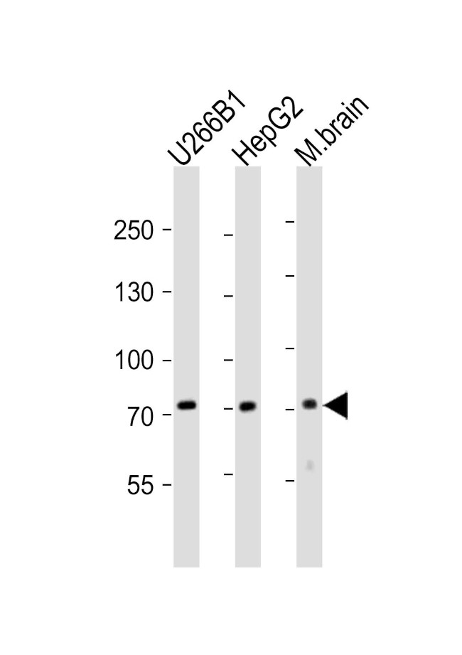 CD73 Antibody in Western Blot (WB)