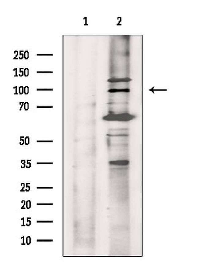 Phospho-Progesterone Receptor (Ser345) Antibody in Western Blot (WB)