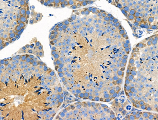 Phospho-SGOL1 (Ser14) Antibody in Immunohistochemistry (Paraffin) (IHC (P))