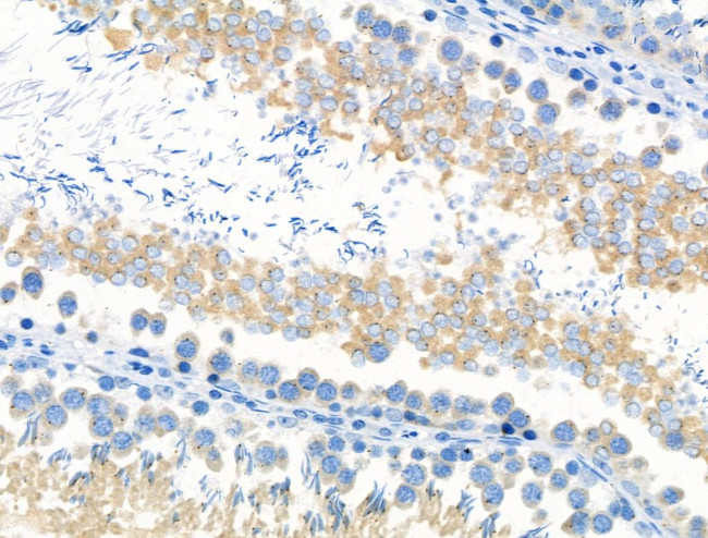 Phospho-SGOL1 (Ser14) Antibody in Immunohistochemistry (Paraffin) (IHC (P))