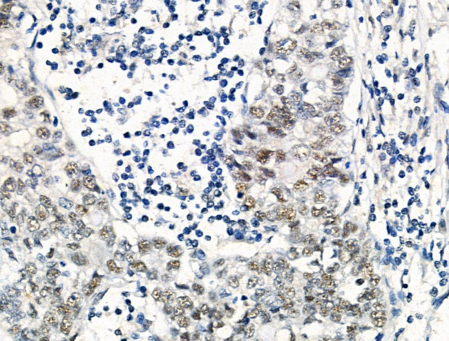 Phospho-SRF (Thr159) Antibody in Immunohistochemistry (Paraffin) (IHC (P))