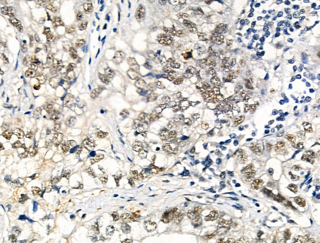 Phospho-SRF (Thr159) Antibody in Immunohistochemistry (Paraffin) (IHC (P))