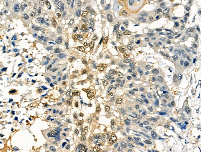 Phospho-SRF (Thr159) Antibody in Immunohistochemistry (Paraffin) (IHC (P))