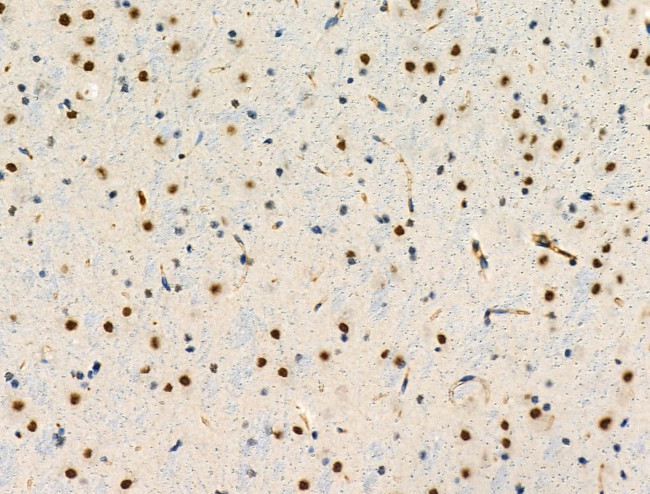 Phospho-SRF (Thr159) Antibody in Immunohistochemistry (Paraffin) (IHC (P))