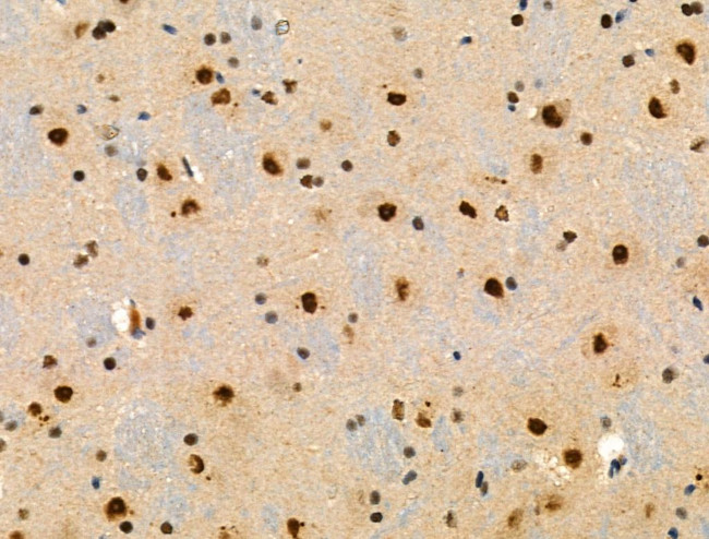 Phospho-SRF (Thr159) Antibody in Immunohistochemistry (Paraffin) (IHC (P))