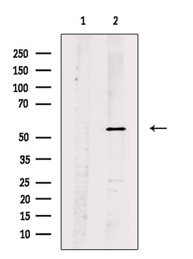 Phospho-SRF (Thr159) Antibody in Western Blot (WB)