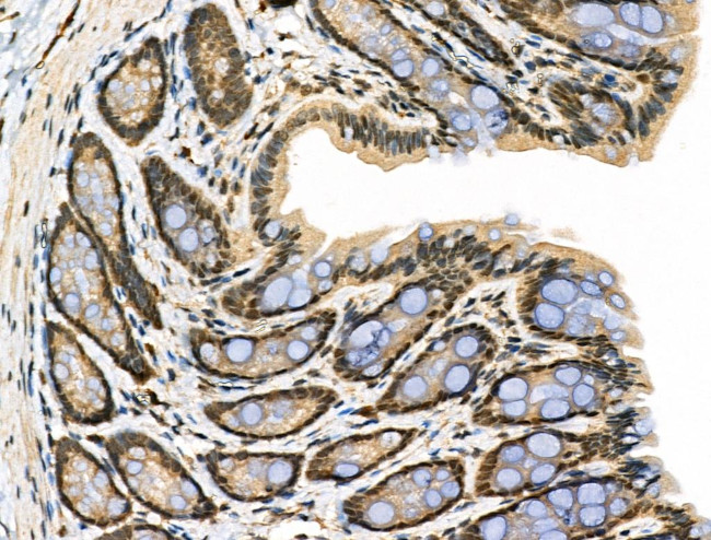 Phospho-TAB1 (Ser438) Antibody in Immunohistochemistry (Paraffin) (IHC (P))