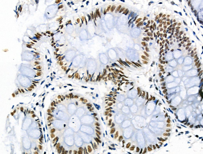 Phospho-Cyclin E (Ser399) Antibody in Immunohistochemistry (Paraffin) (IHC (P))