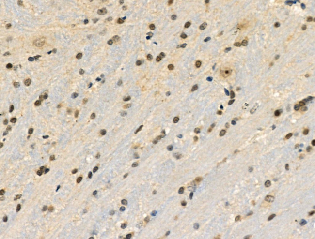 Phospho-Cyclin E (Ser399) Antibody in Immunohistochemistry (Paraffin) (IHC (P))