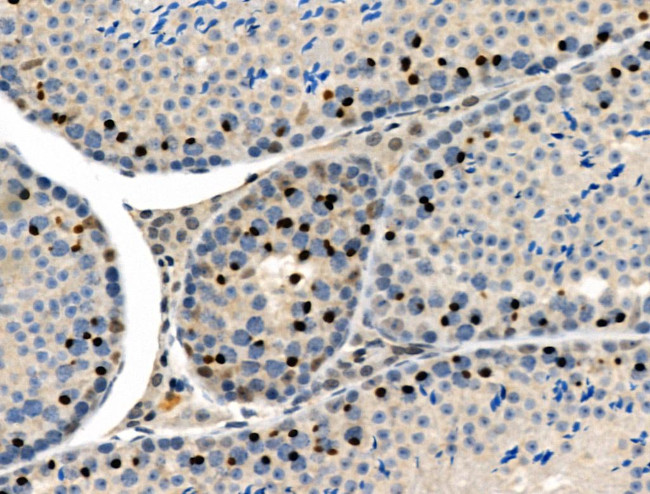 Phospho-Cyclin E (Ser399) Antibody in Immunohistochemistry (Paraffin) (IHC (P))