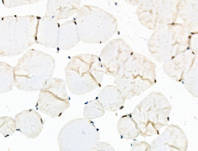 Phospho-Cyclin E (Ser399) Antibody in Immunohistochemistry (Paraffin) (IHC (P))