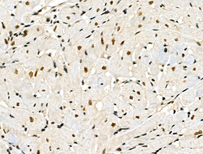 Phospho-Cyclin E (Ser399) Antibody in Immunohistochemistry (Paraffin) (IHC (P))