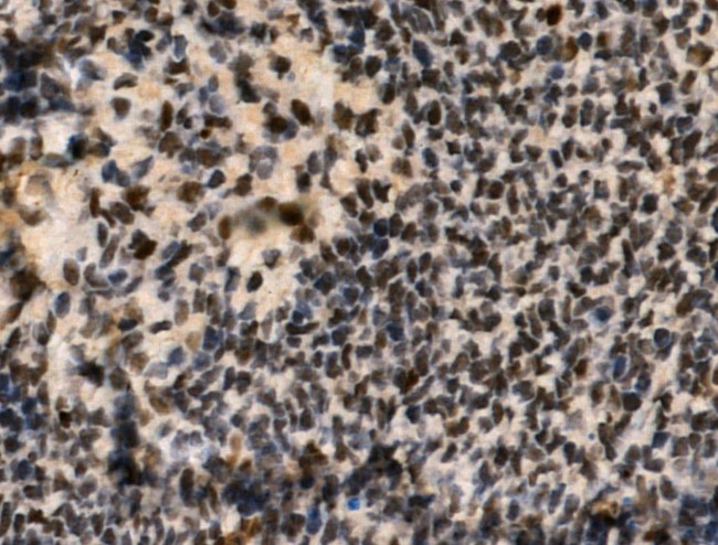 Phospho-Cyclin E (Ser399) Antibody in Immunohistochemistry (Paraffin) (IHC (P))