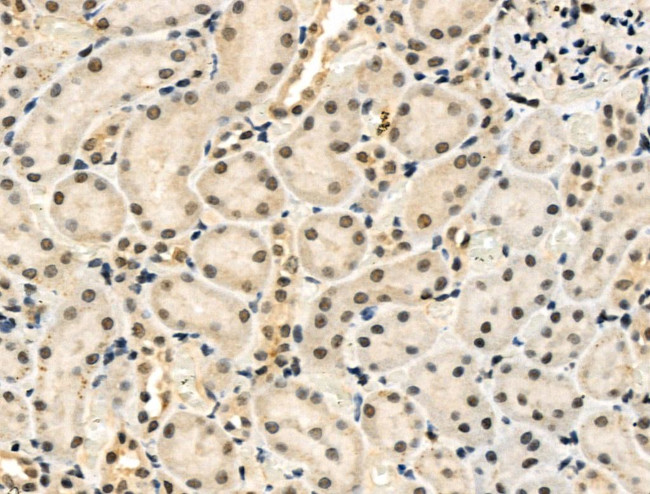 Phospho-Cyclin E (Ser399) Antibody in Immunohistochemistry (Paraffin) (IHC (P))