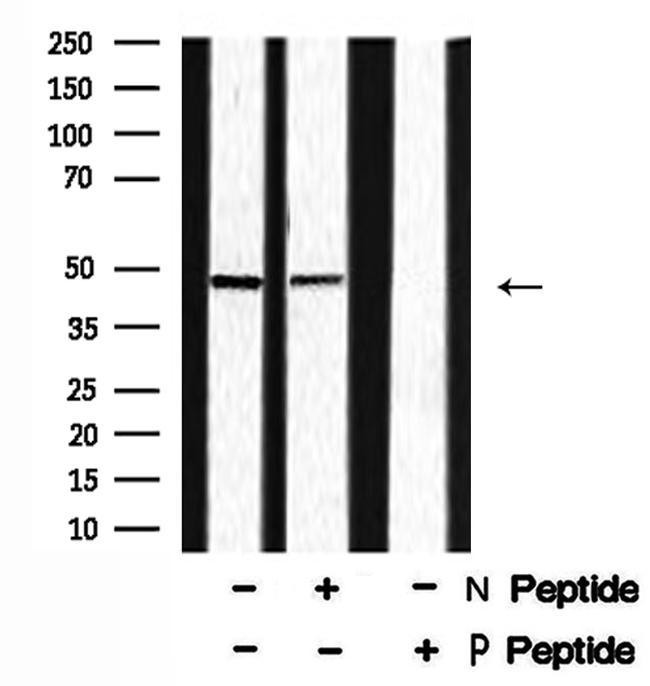 Phospho-Cyclin E (Ser399) Antibody in Western Blot (WB)