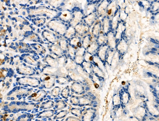 Phospho-DOK2 (Tyr345) Antibody in Immunohistochemistry (Paraffin) (IHC (P))