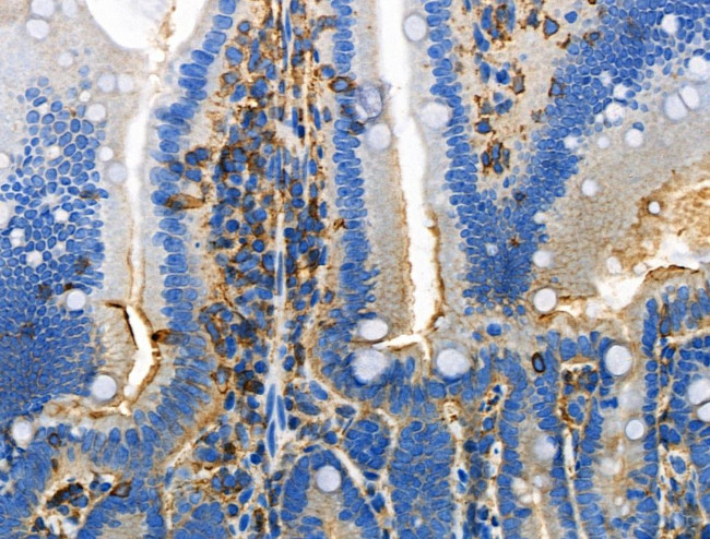 Phospho-DOK2 (Tyr345) Antibody in Immunohistochemistry (Paraffin) (IHC (P))