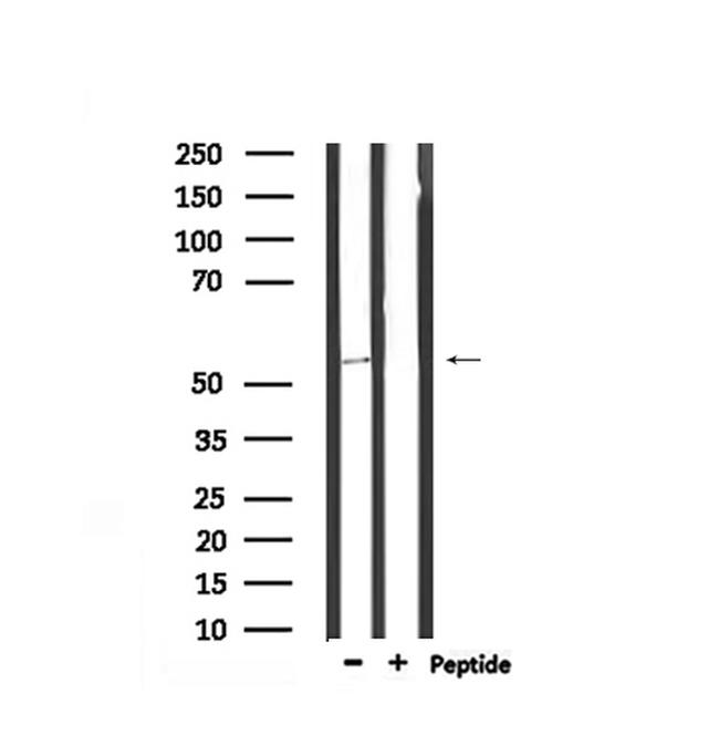 Phospho-DOK2 (Tyr345) Antibody in Western Blot (WB)