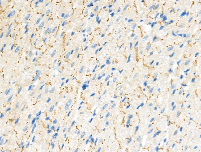 Phospho-Raptor (Ser792) Antibody in Immunohistochemistry (Paraffin) (IHC (P))