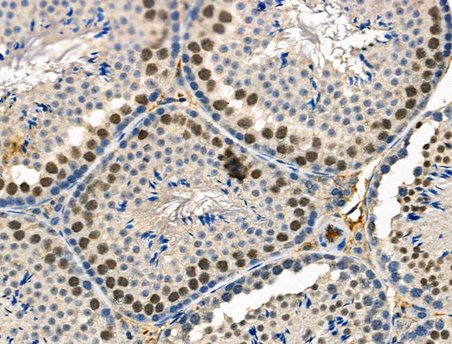 Phospho-ETS1 (Ser251) Antibody in Immunohistochemistry (Paraffin) (IHC (P))