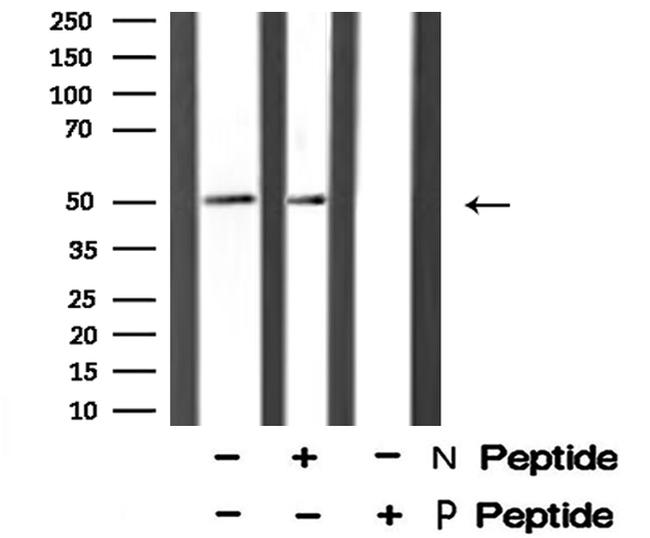 Phospho-ETS1 (Ser251) Antibody in Western Blot (WB)