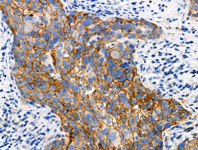 Phospho-GRK1/GRK2 (Tyr13) Antibody in Immunohistochemistry (Paraffin) (IHC (P))