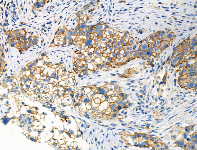 Phospho-GRK1/GRK2 (Tyr13) Antibody in Immunohistochemistry (Paraffin) (IHC (P))