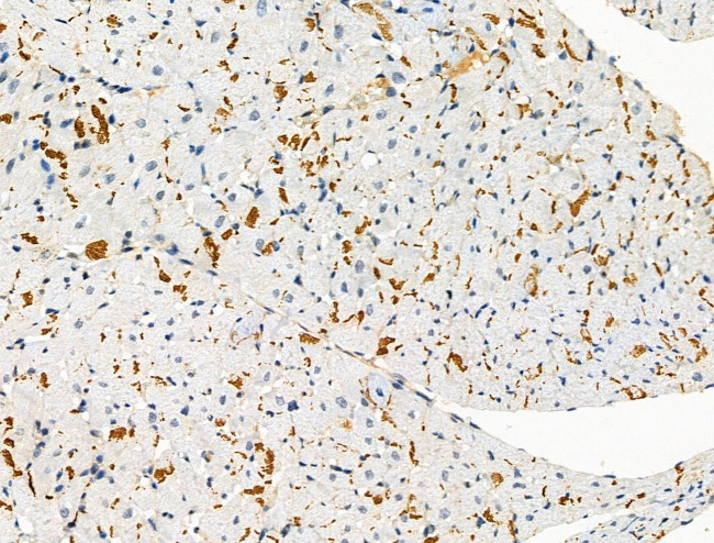 Phospho-PKC alpha (Ser657) Antibody in Immunohistochemistry (Paraffin) (IHC (P))